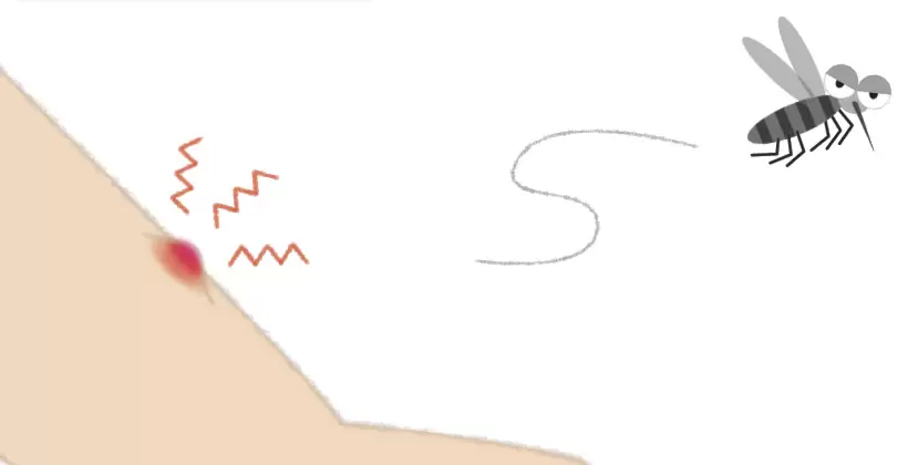 蚊に刺され