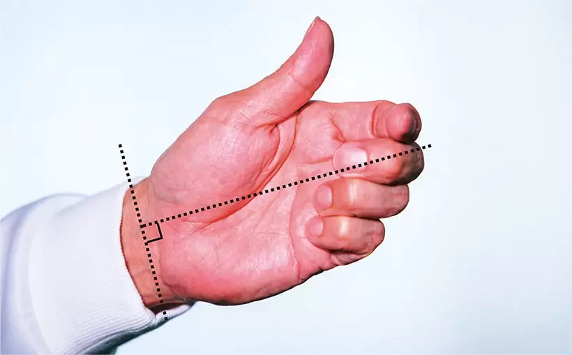 「良肢位」（りょうしい）とは身体にとって自然な、気持ちのよい姿勢。つまり合理的な「機能的な基本肢位」を表す。手関節のしわに対して第3指の向きがほぼ直角になるような位置取り。