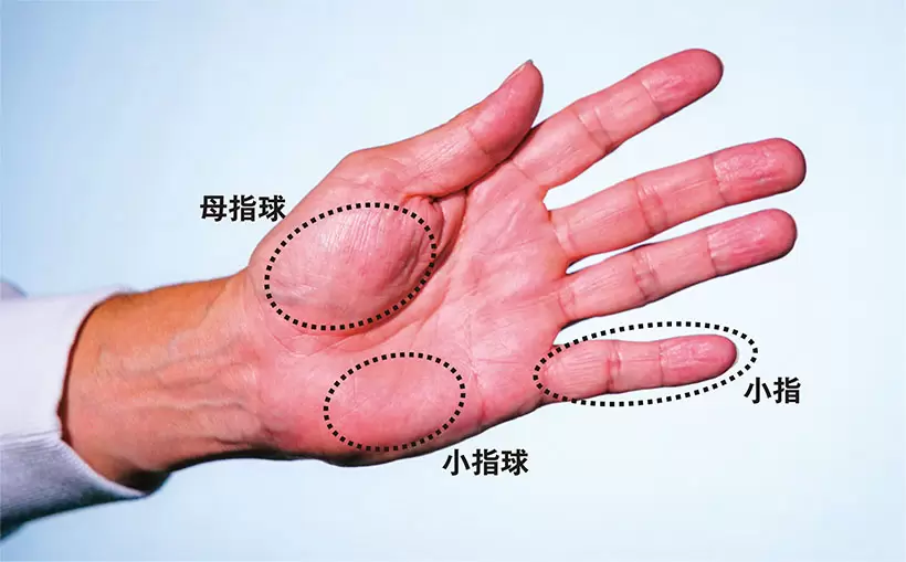 「左手の3支持」を構成するのは（1）左小指（2）左母指球（3）左母指。